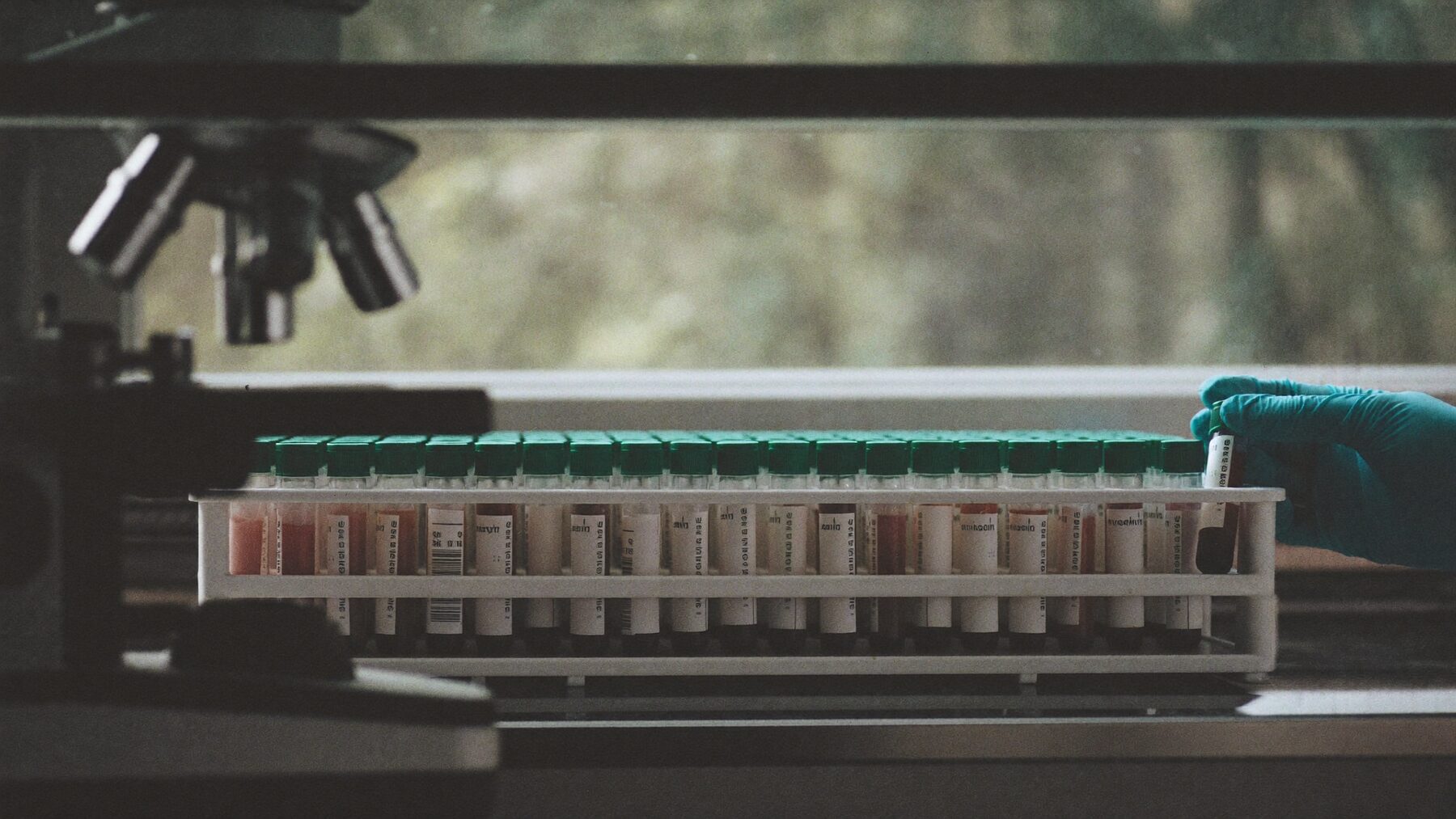 A rack of blood sample tubes on a laboratory bench